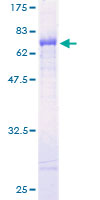 12.5% SDS-PAGE Stained with Coomassie Blue.